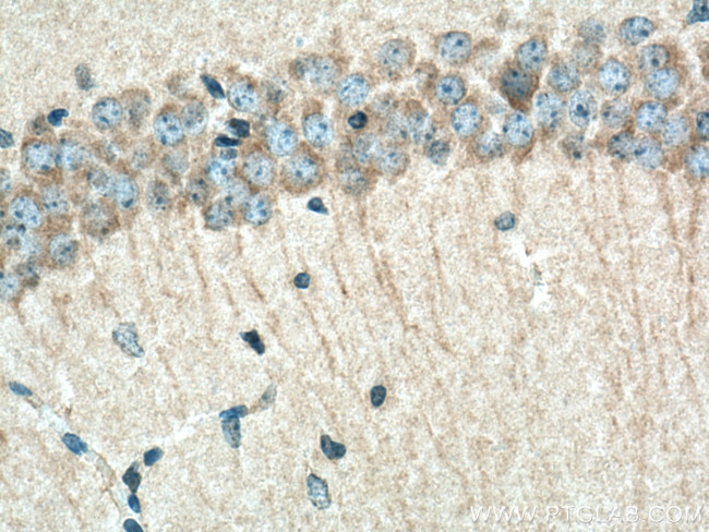 PHACTR1 Antibody in Immunohistochemistry (Paraffin) (IHC (P))