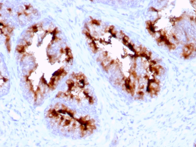 FOLH1/PSMA Antibody in Immunohistochemistry (Paraffin) (IHC (P))