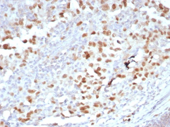 PRAME nuclear receptor transcriptional regulator Antibody in Immunohistochemistry (Paraffin) (IHC (P))