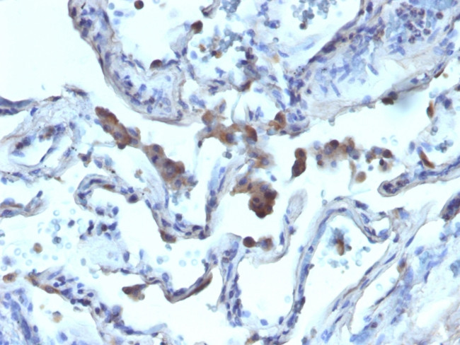 AMACR/p504S (Prostate Cancer Marker) Antibody in Immunohistochemistry (Paraffin) (IHC (P))