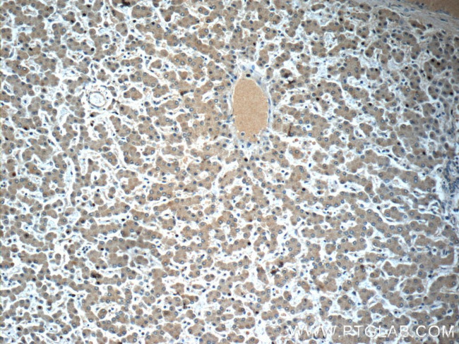 LYRM7 Antibody in Immunohistochemistry (Paraffin) (IHC (P))