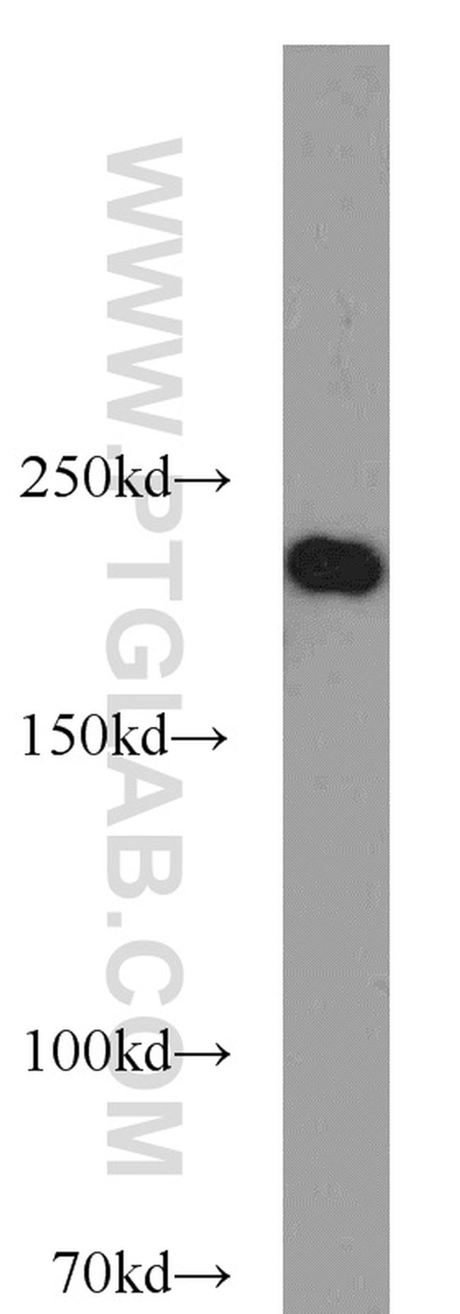 SNRNP200 Antibody in Western Blot (WB)