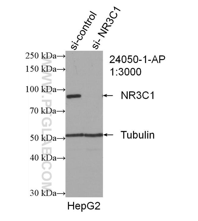 Glucocorticoid receptor Antibody in Western Blot (WB)