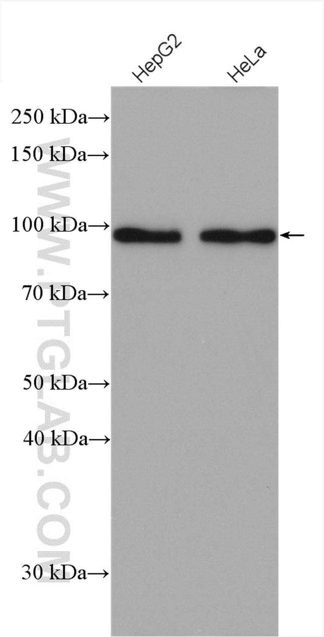 Glucocorticoid receptor Antibody in Western Blot (WB)