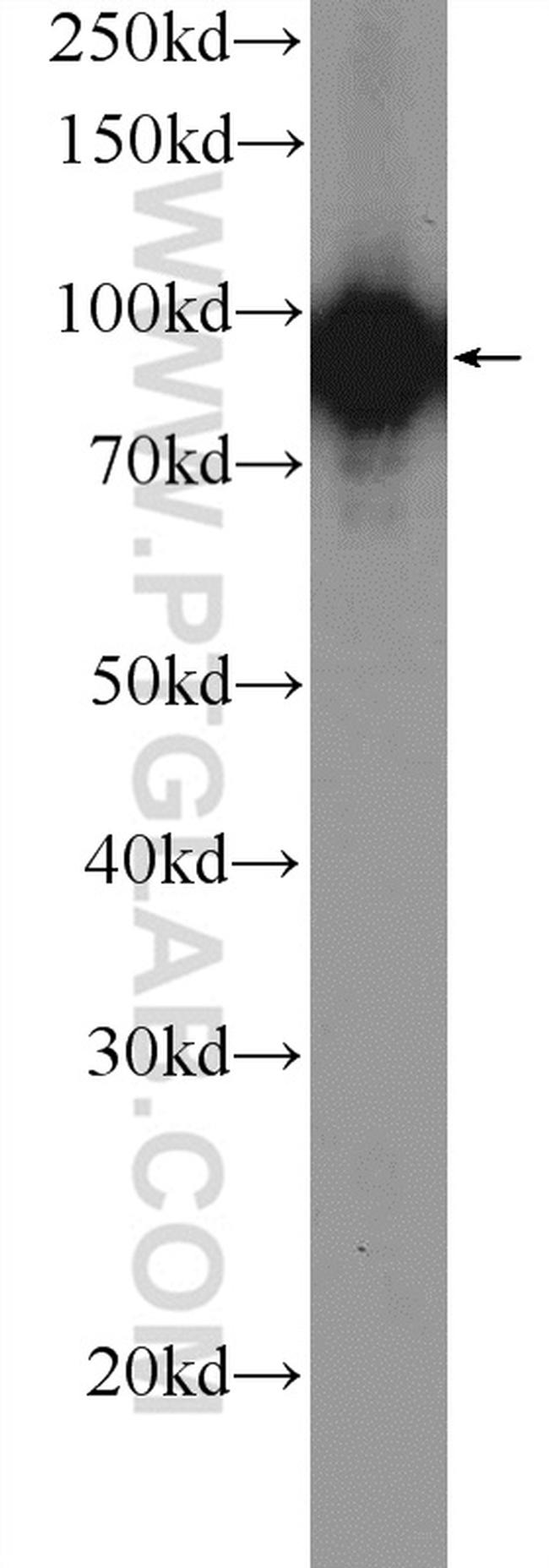 Glucocorticoid receptor Antibody in Western Blot (WB)