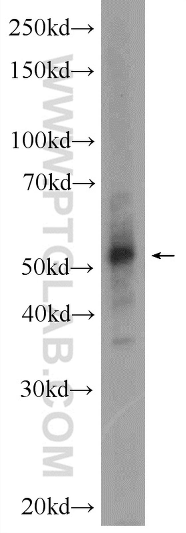 SETD6 Antibody in Western Blot (WB)