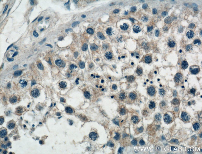 SPAG9 Antibody in Immunohistochemistry (Paraffin) (IHC (P))