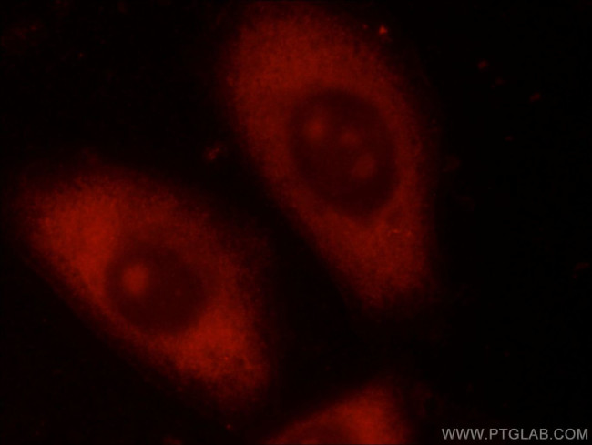 HPSE Antibody in Immunocytochemistry (ICC/IF)