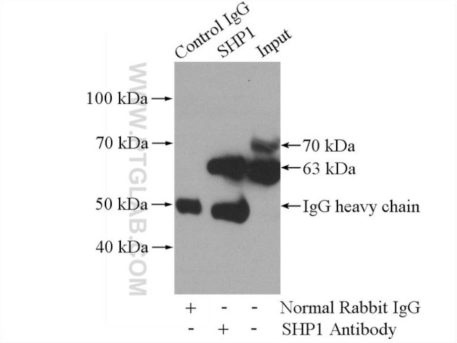 SHP1 Antibody in Immunoprecipitation (IP)