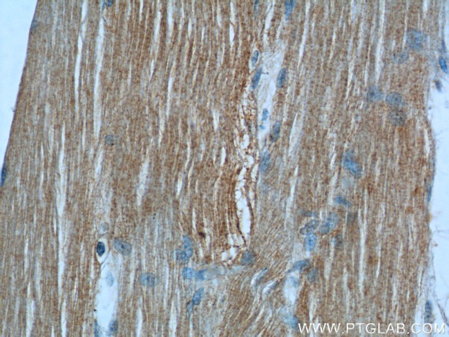 MBNL3 Antibody in Immunohistochemistry (Paraffin) (IHC (P))