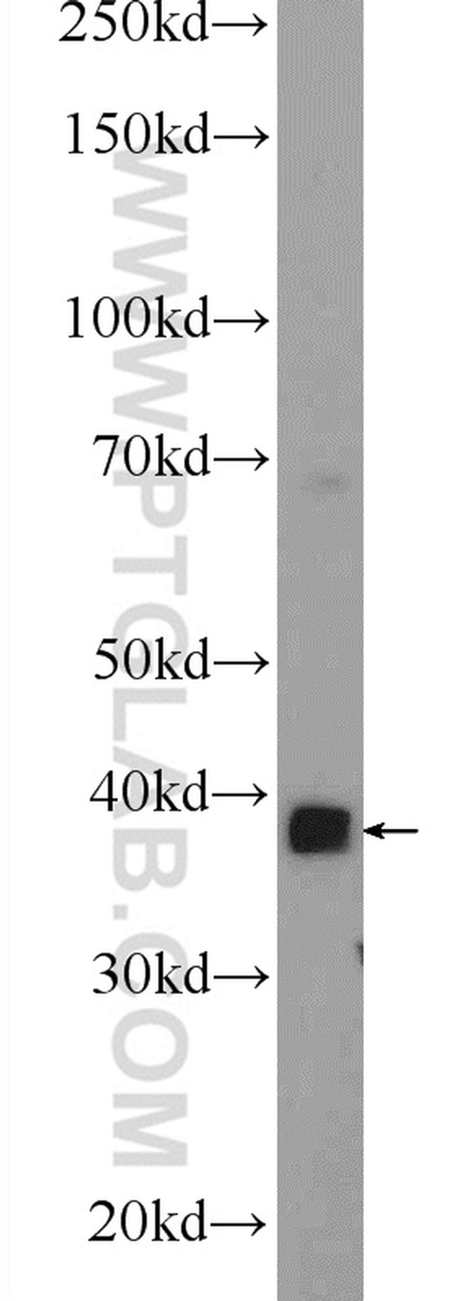 MBNL3 Antibody in Western Blot (WB)