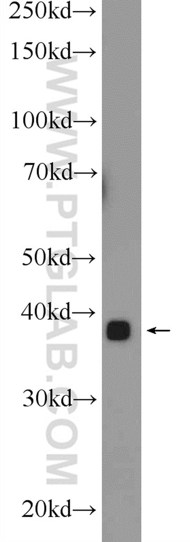 MBNL3 Antibody in Western Blot (WB)