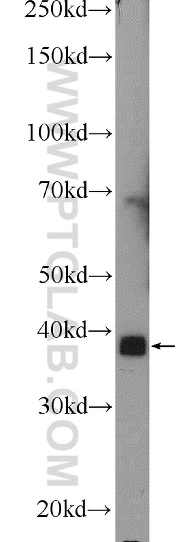 MBNL3 Antibody in Western Blot (WB)