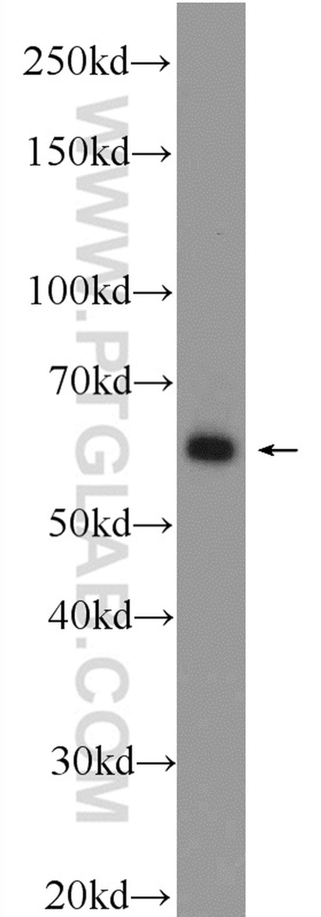 EHD1 Antibody in Western Blot (WB)