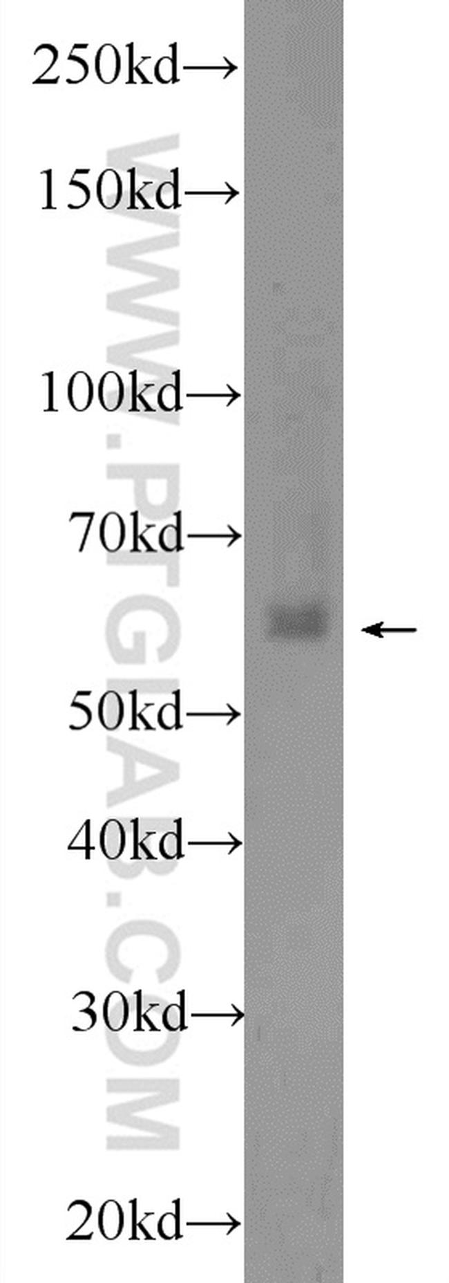 EHD1 Antibody in Western Blot (WB)