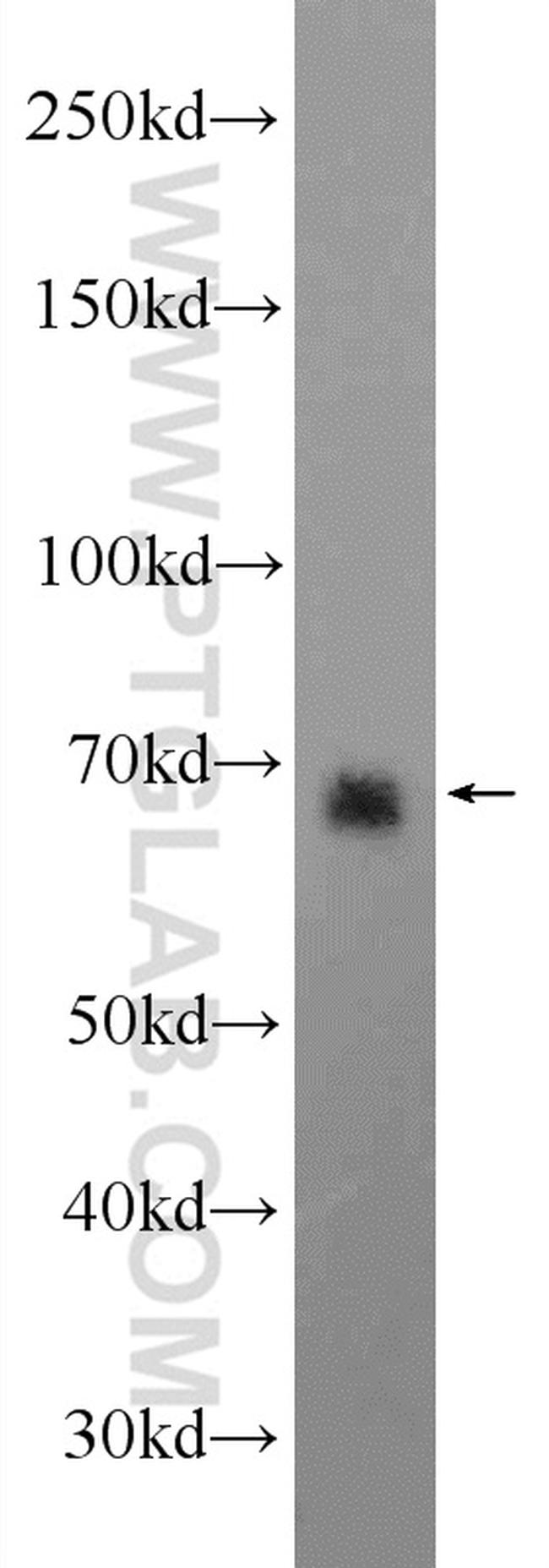 CCDC99 Antibody in Western Blot (WB)