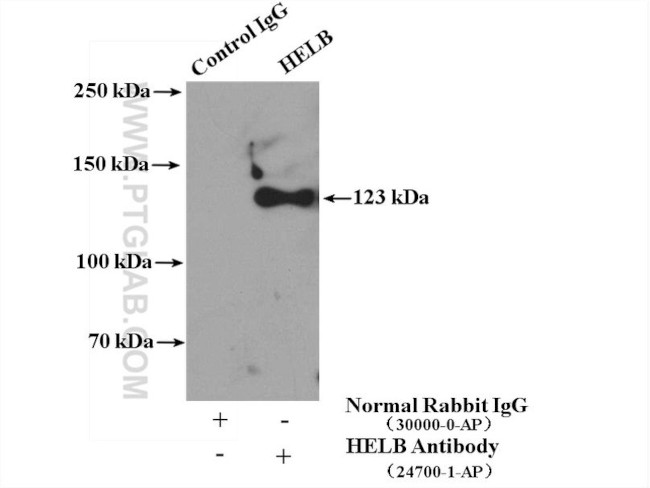 HELB Antibody in Immunoprecipitation (IP)