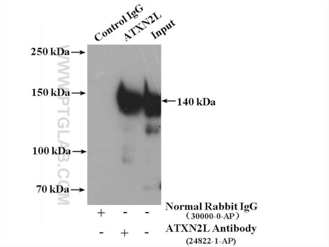 ATXN2L Antibody in Immunoprecipitation (IP)