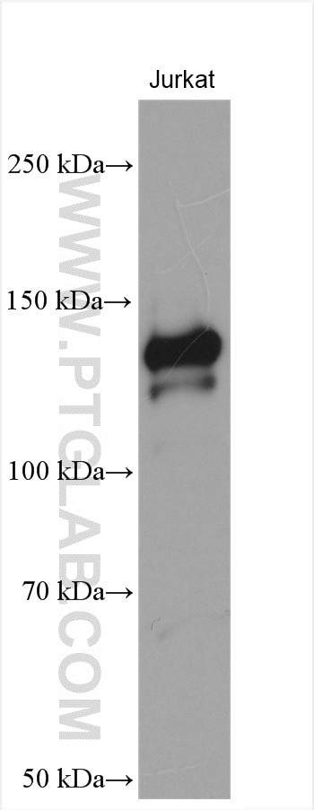 ATXN2L Antibody in Western Blot (WB)