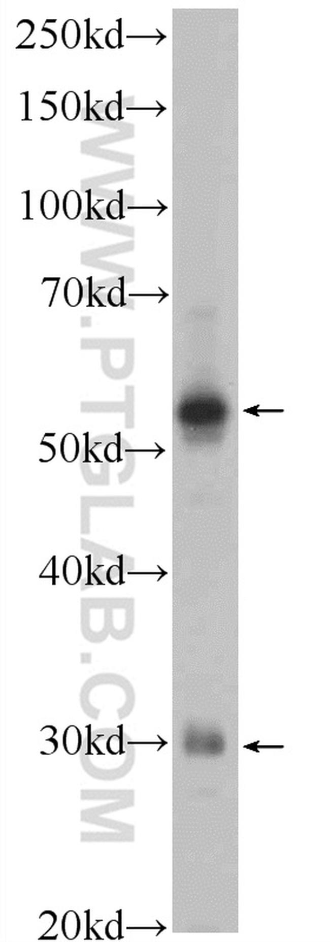 XBP1S Antibody in Western Blot (WB)