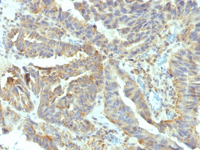 Alkaline Phosphatase (Tissue-Nonspecific) Antibody in Immunohistochemistry (Paraffin) (IHC (P))