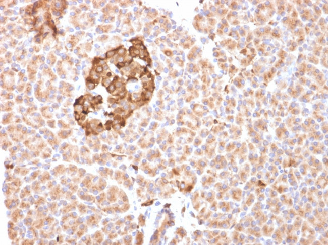 Ferritin, Heavy Chain (FTH) Antibody in Immunohistochemistry (Paraffin) (IHC (P))