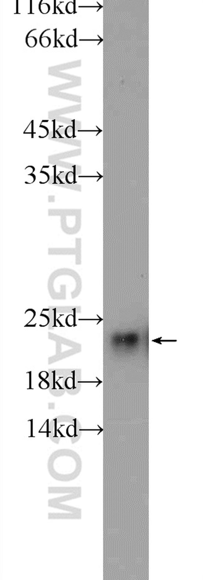 RSL24D1 Antibody in Western Blot (WB)
