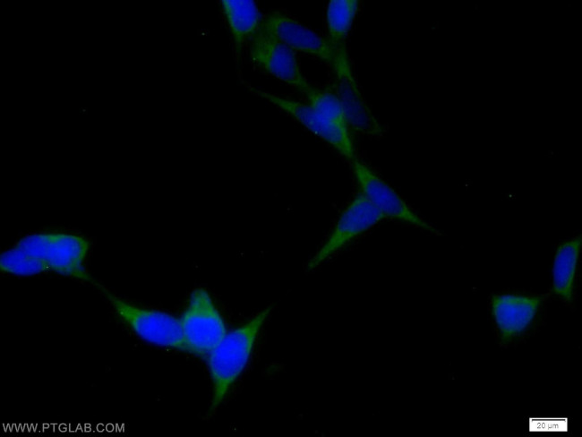 DTX4 Antibody in Immunocytochemistry (ICC/IF)