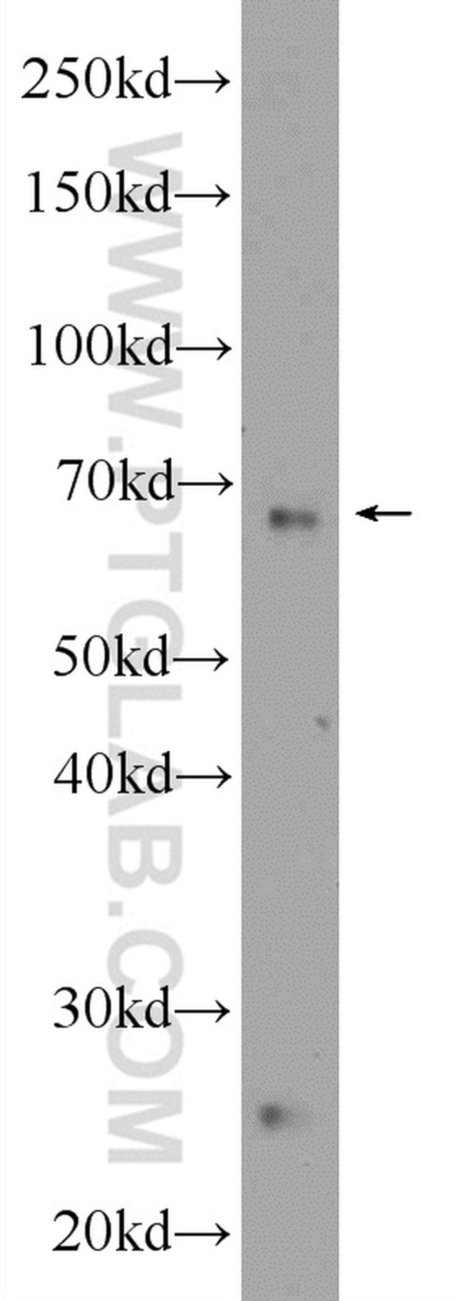 NCOA6 Antibody in Western Blot (WB)