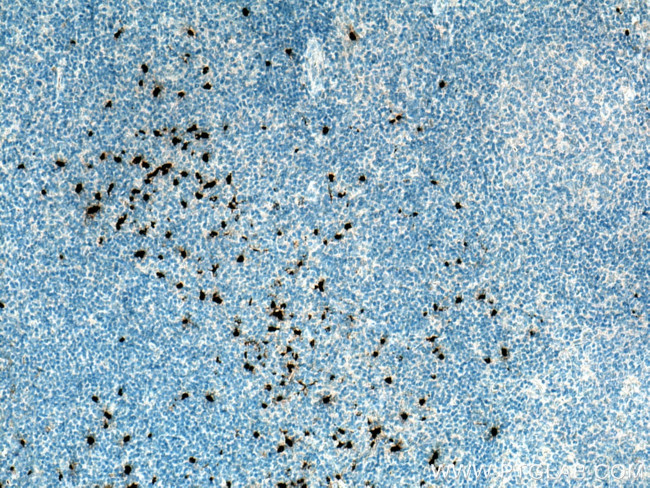 PRTN3 Antibody in Immunohistochemistry (Paraffin) (IHC (P))