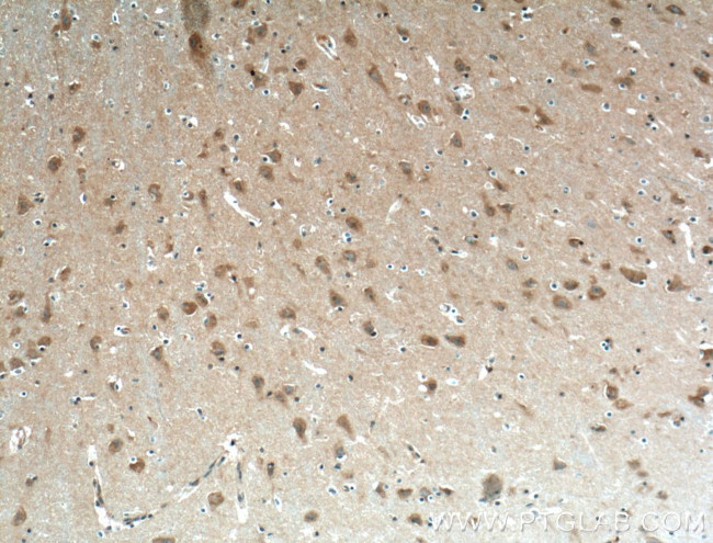 EHD3 Antibody in Immunohistochemistry (Paraffin) (IHC (P))