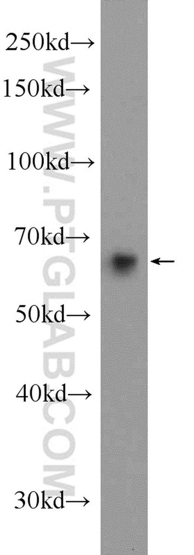 EHD3 Antibody in Western Blot (WB)