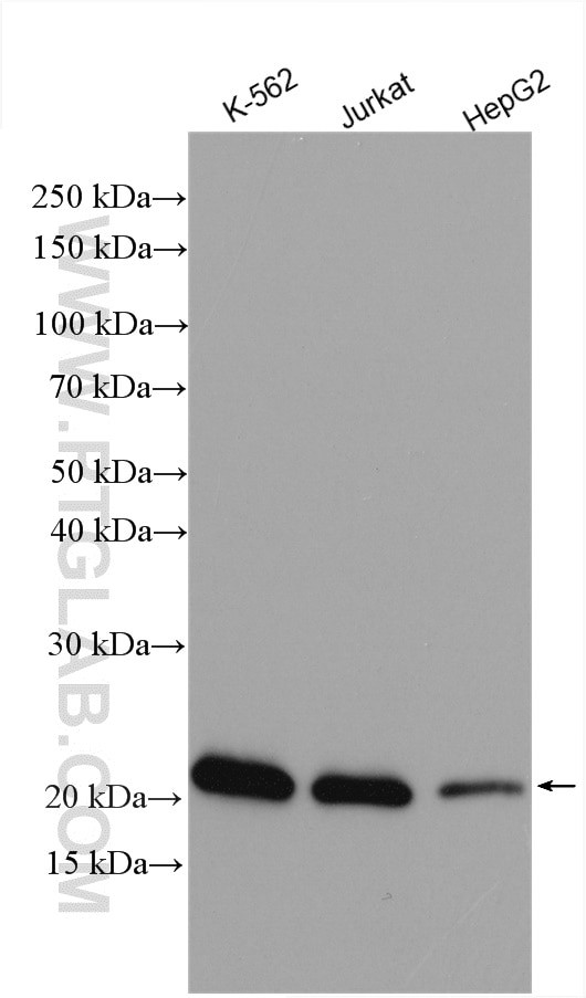 C6orf108 Antibody in Western Blot (WB)