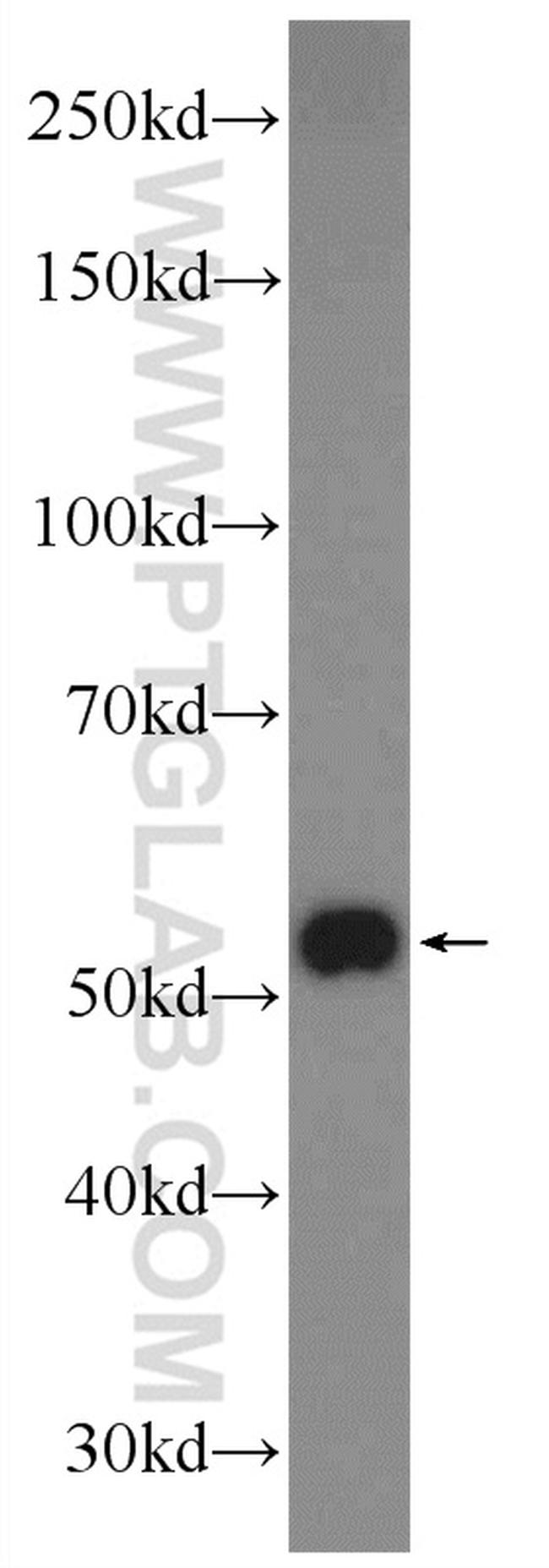 ZNF394 Antibody in Western Blot (WB)