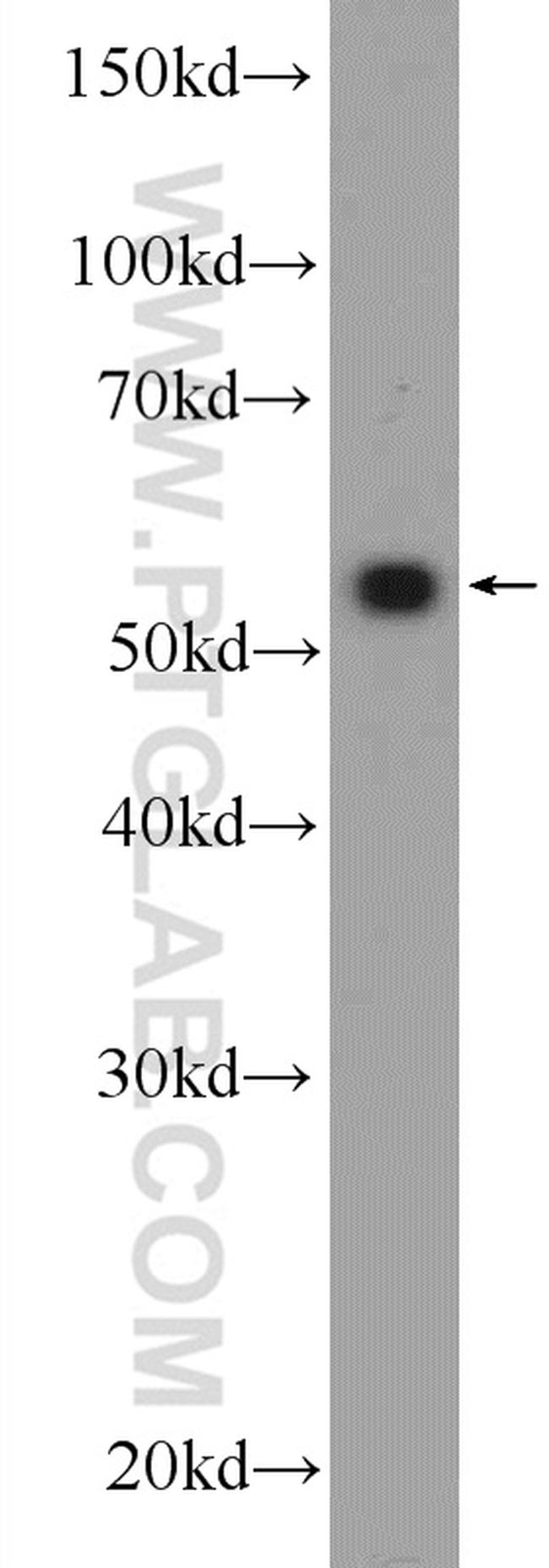 ZNF394 Antibody in Western Blot (WB)