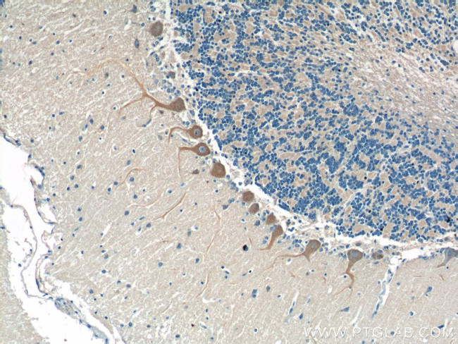 CSF1R Antibody in Immunohistochemistry (Paraffin) (IHC (P))