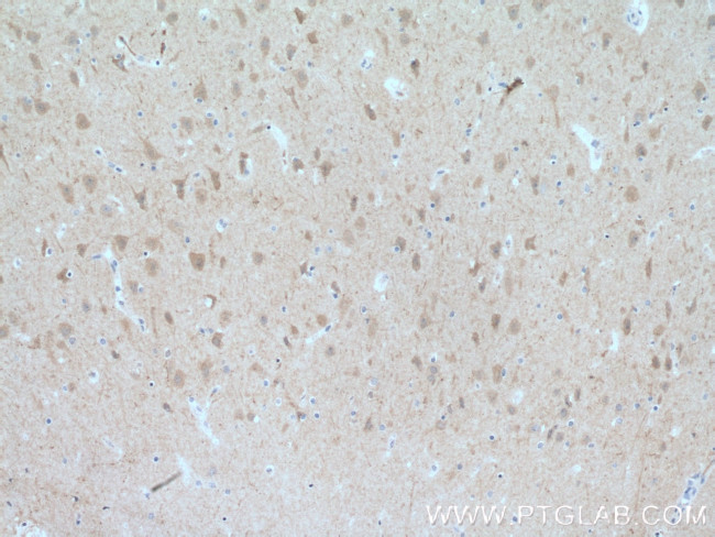 FBXL16 Antibody in Immunohistochemistry (Paraffin) (IHC (P))