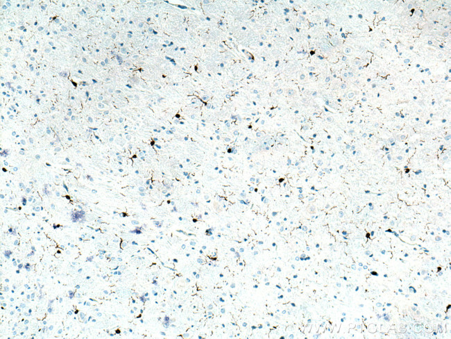 IBA1 Antibody in Immunohistochemistry (Paraffin) (IHC (P))