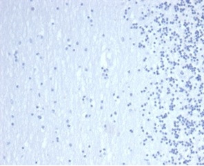 GATA-3 (Center) (Breast and Urothelial Marker) Antibody in Immunohistochemistry (Paraffin) (IHC (P))