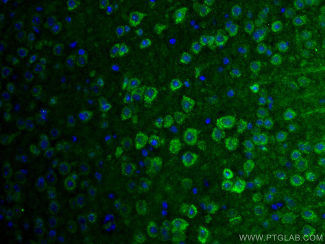 SLC25A47 Antibody in Immunohistochemistry (Paraffin) (IHC (P))