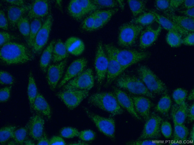 C19orf21 Antibody in Immunocytochemistry (ICC/IF)