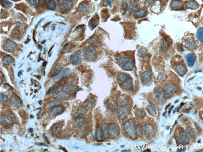 CPA4 Antibody in Immunohistochemistry (Paraffin) (IHC (P))