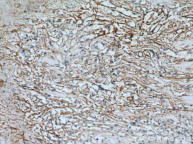 xCT Antibody in Immunohistochemistry (Paraffin) (IHC (P))