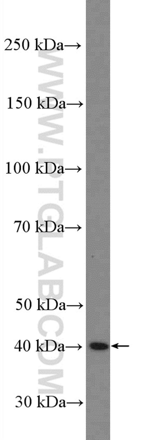 xCT Antibody in Western Blot (WB)