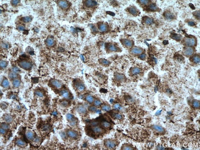 xCT Antibody in Immunohistochemistry (Paraffin) (IHC (P))