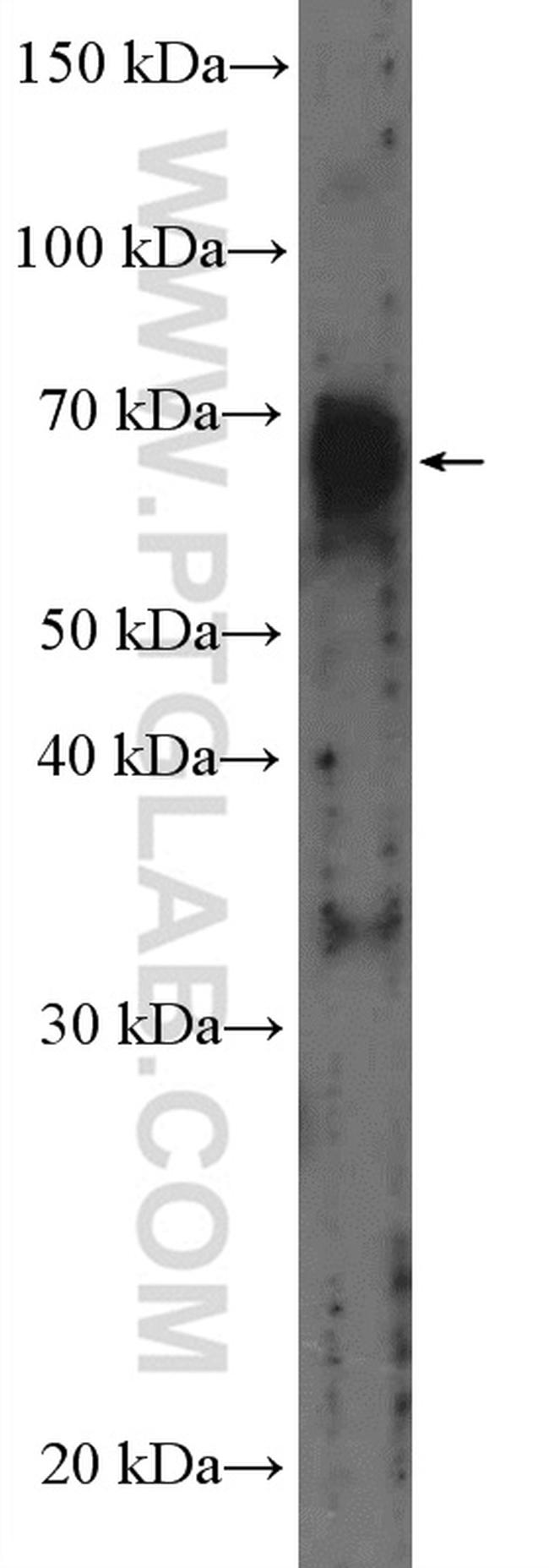 CSGALNACT1 Antibody in Western Blot (WB)