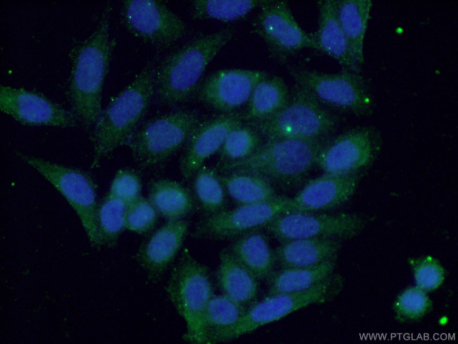 S100A9 Antibody in Immunocytochemistry (ICC/IF)