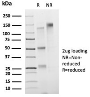 FOXB1 (Transcription Factor) Antibody in SDS-PAGE (SDS-PAGE)