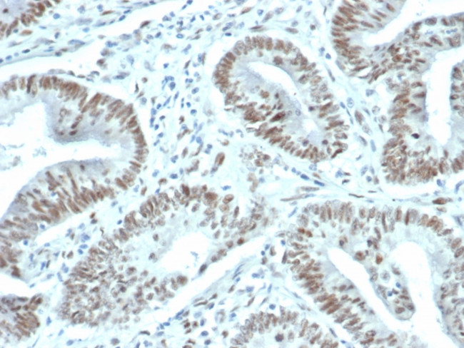 FOXP1 (Transcription Factor) Antibody in Immunohistochemistry (Paraffin) (IHC (P))