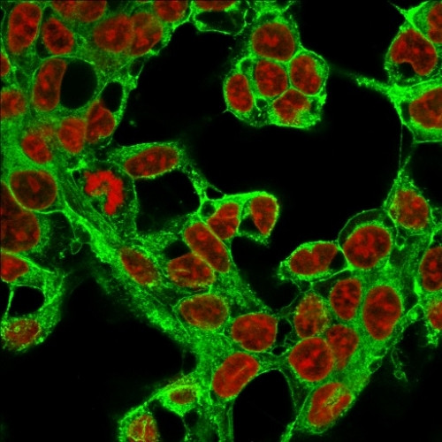 Glypican-3 (GPC3) (Hepatocellular Carcinoma Marker) Antibody in Immunocytochemistry (ICC/IF)